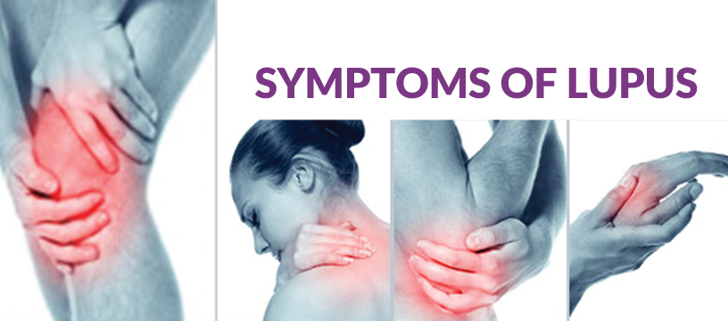 some-signs-you-are-suffering-from-lupus-mylot