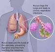 cystic fibrosis - this cystic fibrosis picture in the lung
