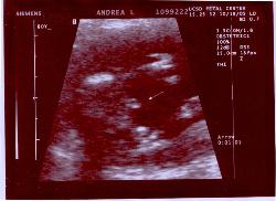 It&#039;s a BOY! - It&#039;s a boy ultrasound photo