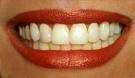 Color of teeth - teeth set