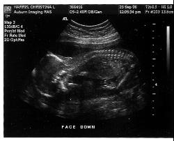 My Ultrasound - Ultrasound