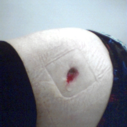 Bullet hole in my hip - This is the result of incompetent police officers on the loose, after this comes lies, lies and more lies, oh, and corruption.