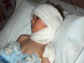 Cody dog attack April 7th 2007 - Day before Easter my son in Hospital with 60 stitches and 20 staples after dad attack in his own backyard. Cody dog attack April 7th 2007 - Day before Easter my son in Hospital with 60 stitches and 20 staples after dad attack in his own backyard.