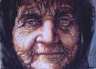 Wrinkled skin - being out in the sun too long gives you the old leather skin look Wrinkled skin - being out in the sun too long gives you the old leather skin look