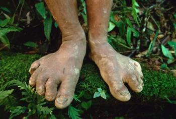 dirty feet - dirty feet on a forest