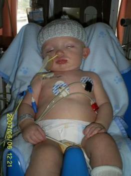 Kaleb  - Pictures of baby Kaleb Schwade - In hospital fighting for his life from SBS!