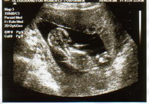 Fetus - the first picture of my son