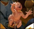 Process of childbirth - Infant just born