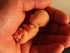 life - 12 week foetus