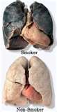 smokers lung to normal lung - This should scare kids from ever starting to smoke for it&#039;s so NOT cool!