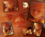 fetus - pictures of fetus fetus - pictures of fetus