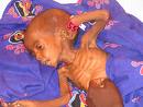 Starving Child - i think this is more than the mother could handle. obviously she can&#039;t manage to feed her child.