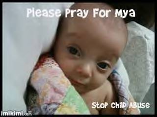 pray for mya!! - Please send well wishes and prayer for baby Mya!