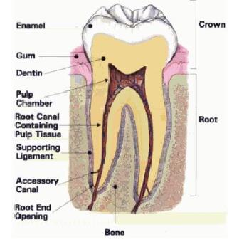Root Canal - Root canal..