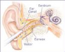 ears - structure of ears and how to clean it
