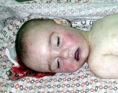 Wars leave mothers childles and children orphans - A baby killed by a Palestine sniper