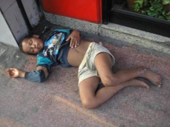 Picture of Poverty - A poor child showing the proof of a hard life.
