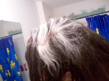 My white hair. - The white hair that I started getting at 17, only one year ago.