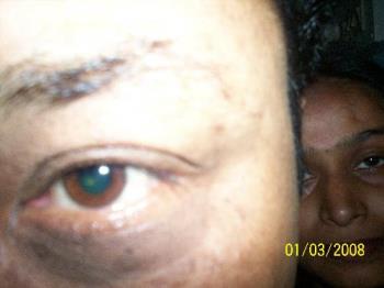 an aggressive eye of a person - this is a picture of an eye of a person.