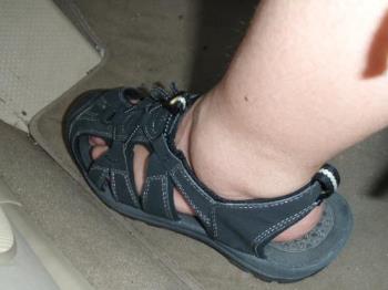 Swollen ankle - Both of my ankles are this swollen Swollen ankle - Both of my ankles are this swollen
