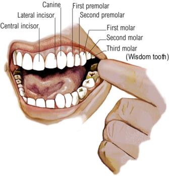 Wisdom Teeth can be painful - So remove it ,some just ignore it.