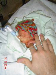 kody wallace - this was kody at 2 weeks old..... my second premature son, born at 28 weeks.