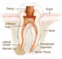 my problem now - tooth problem