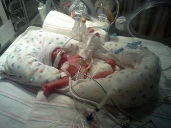 Baby Alijah - My first grandson. 1lb. 7.7oz, Hes the biggest fighter I know. 
