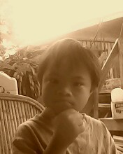 down syndrome - this is a photo of a child with down syndrome down syndrome - this is a photo of a child with down syndrome