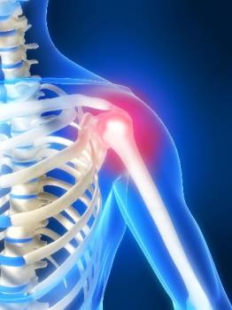 Shoulder Pain - This is a good depiction of where the pain is. And boy does it hurt. Shoulder Pain - This is a good depiction of where the pain is. And boy does it hurt.