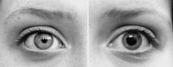 Eyes - What color is yours?