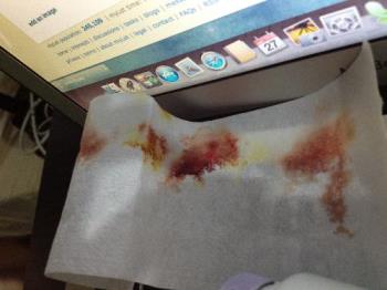 dried blood - This is the wax strip I had used to wrap my cut finger after putting some Betadine on it lol. No bandage wrap at home! dried blood - This is the wax strip I had used to wrap my cut finger after putting some Betadine on it lol. No bandage wrap at home!