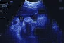ultrasound  - ultrasound of my second. I am not married so its proof it can happen. 