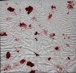 Blood_on_a_napkin - A PHOTO SHOWS BLOOD ON A NAPKIN!