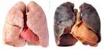 smokers lungs  - smokers lungs What your lungs can look like if you smoke