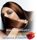 ........clean scalp, clean thinking - dandruff