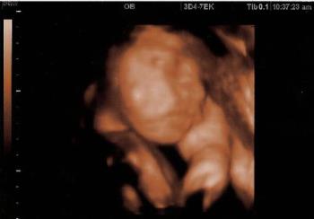 ultrasound  - this is my little logan in the womb