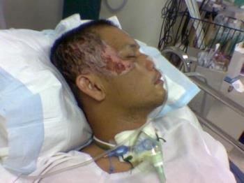 my brother in law  -  I took this picture when he was admitted to ICU........