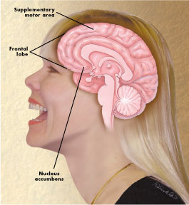 Humer - Affect of humor laughter on brain