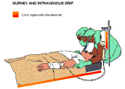 intravenous drip - intravenous drip