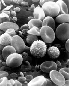 human blood - A scanning electron microscope (SEM) image of normal circulating human blood.
One can see red blood cells, several white blood cells including knobby lymphocytes, a monocyte, a neutrophil, and many small disc-shaped platelets. human blood - A scanning electron microscope (SEM) image of normal circulating human blood.
One can see red blood cells, several white blood cells including knobby lymphocytes, a monocyte, a neutrophil, and many small disc-shaped platelets.