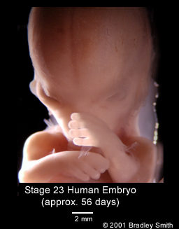 embryo - 53 days old embryo
