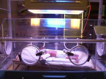 a baby born too early  - in his artificial womb