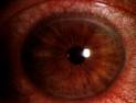 eye - eye eye - eye
