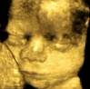 3D fetal face at 28 weeks gestation - baby picture - 3D fetal face at 28 weeks gestation