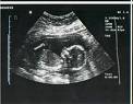 ultrasound - ultrasound are an important process for any mother to be we all look forward to the joy of seeing our unborn child and to feel comforted in the knowledge our baby is still safe