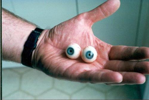 Donate Eyes for a noble cause - The picture may be funny but the cause is really serious one.