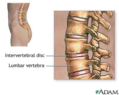 low back pain - spine