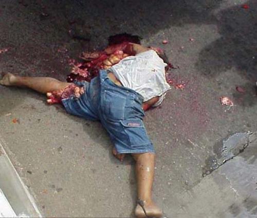 motorcycle accident - Please ride your motorcycle carefully. Otherwise this might happen to you!!