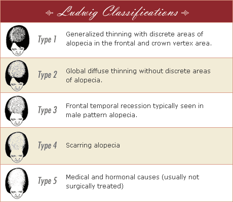 hair fall - hair loss explained